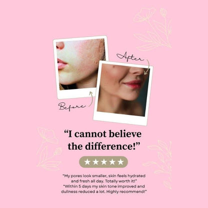 Korean Niacinamide 12% Serum (30 Ml)